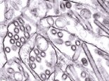 The H5N1 avian flu virus, discovered recently at a turkey farm in Suffolk